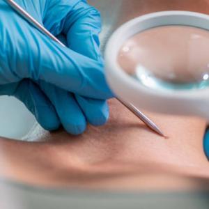 Advancing Skin Treatment Ecosystem Through Clinical Dermatology in France