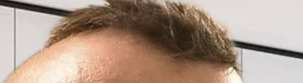 Men’s Hair Unit/Toupee Installation