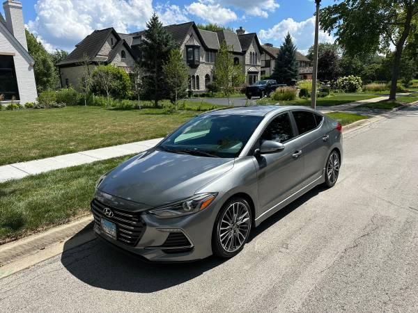 2017 Hyundai Elentra Turbo - $10,700 (Elmhurst)