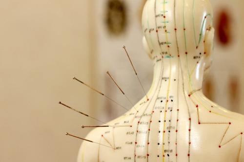 Acupuncture and Chinese Herbal Medicine in Plano, TX