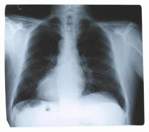 PHOTO COURTESY METROGRAPHICS