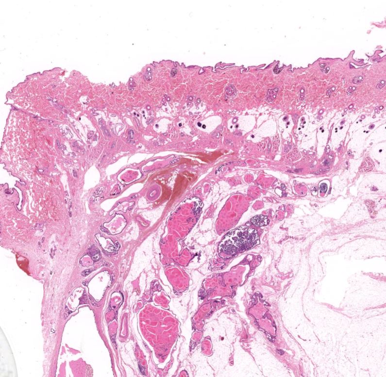 "breast adenocarcinoma from a shepherd dog" KiKo XP
