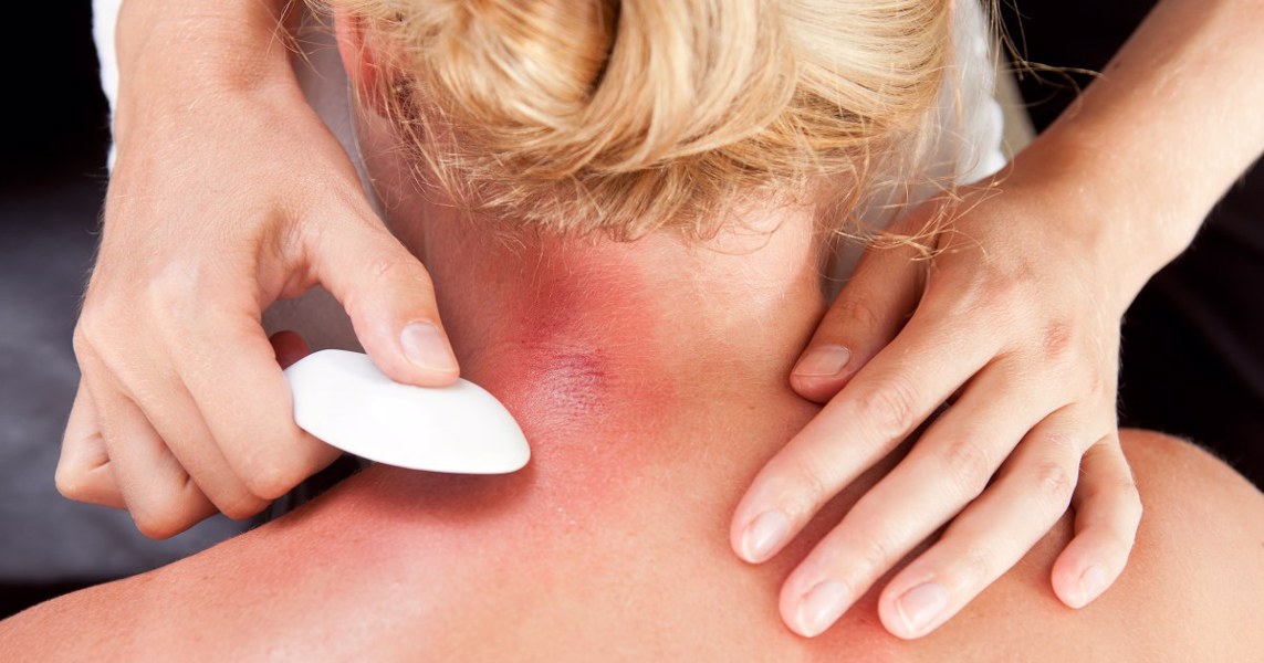 Does gua sha really work? The health benefits of traditional medicine�s
