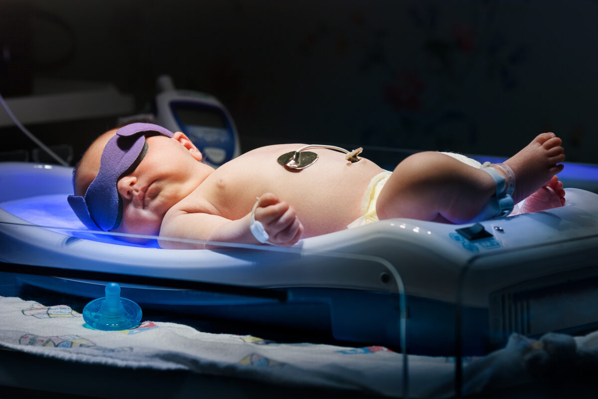 Intermountain Health testing app to ease jaundice detection in newborns | News, Sports, Jobs - Vimarsana News