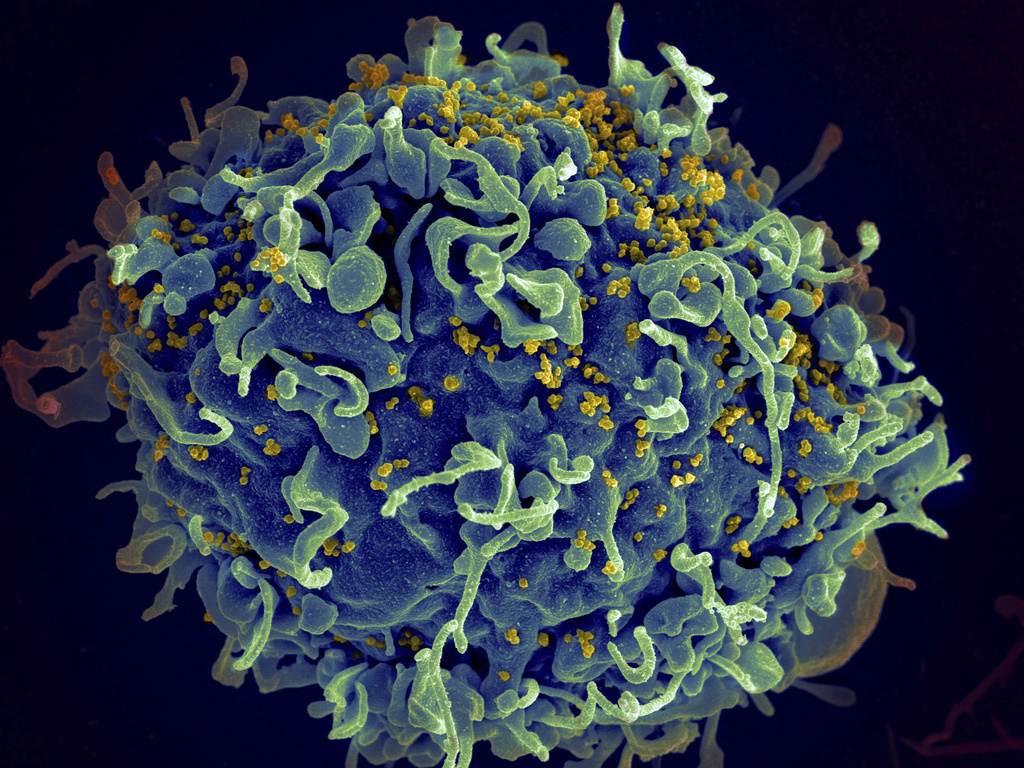 CDC: 'Vampire facials' at an unlicensed spa in New Mexico led to HIV infections in three women | News, Sports, Jobs - Vimarsana News