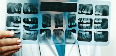 Free dental care offered to veterans | News, Sports, Jobs - Vimarsana News