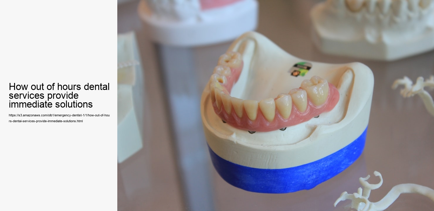 How out of hours dental services provide immediate solutions