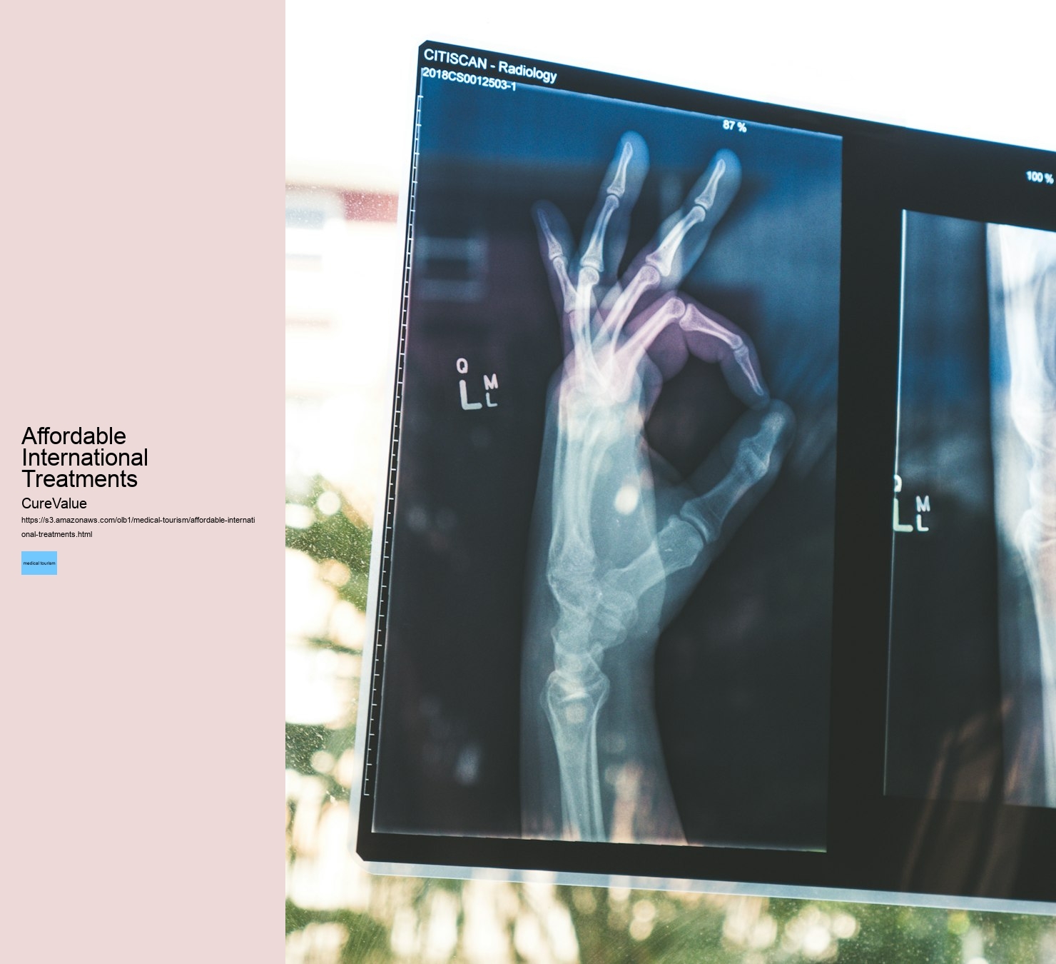 Affordable International Treatments