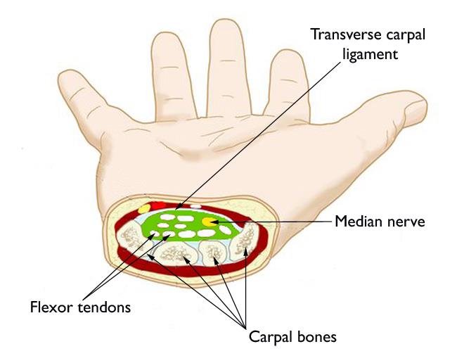 Diagram of hand anatomy (below)