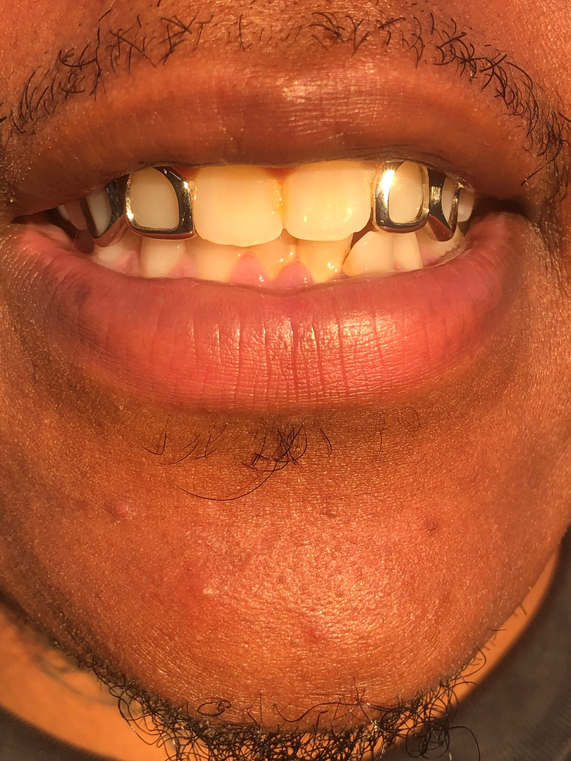 Heru grillz : Diamond gold teeth Logo