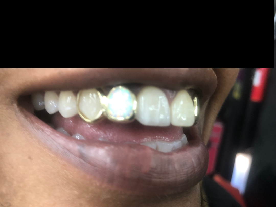 Heru grillz : Diamond gold teeth Image