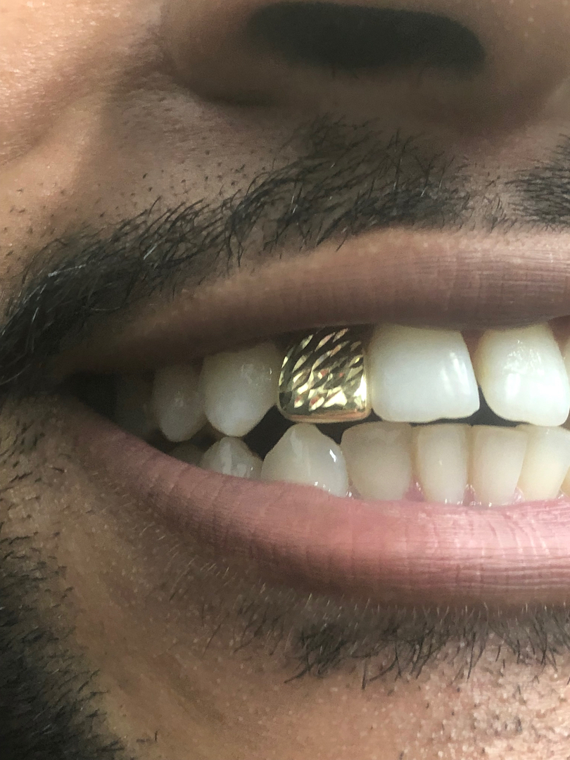 Heru grillz : Diamond gold teeth Image