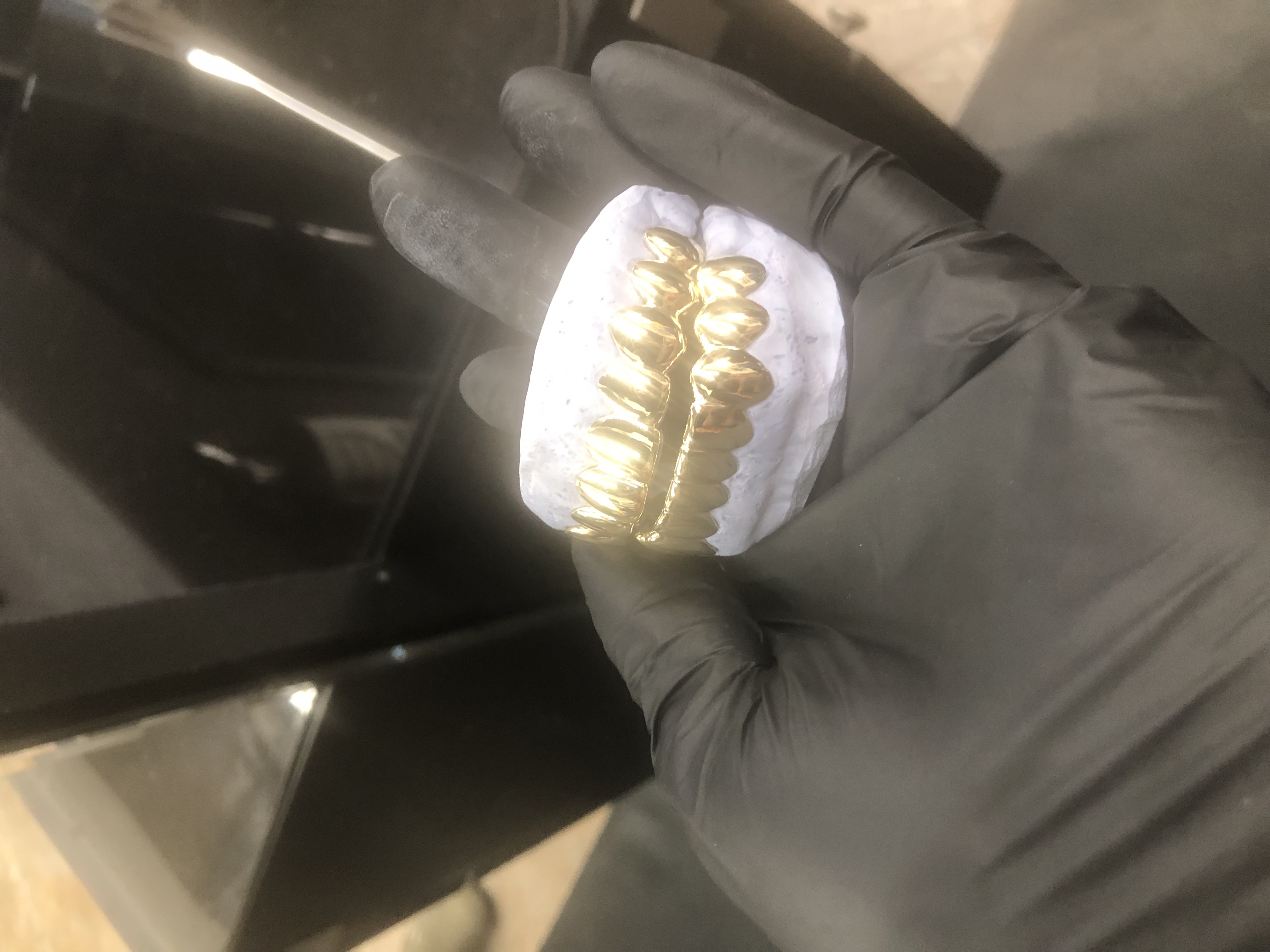 Heru grillz : Diamond gold teeth Image