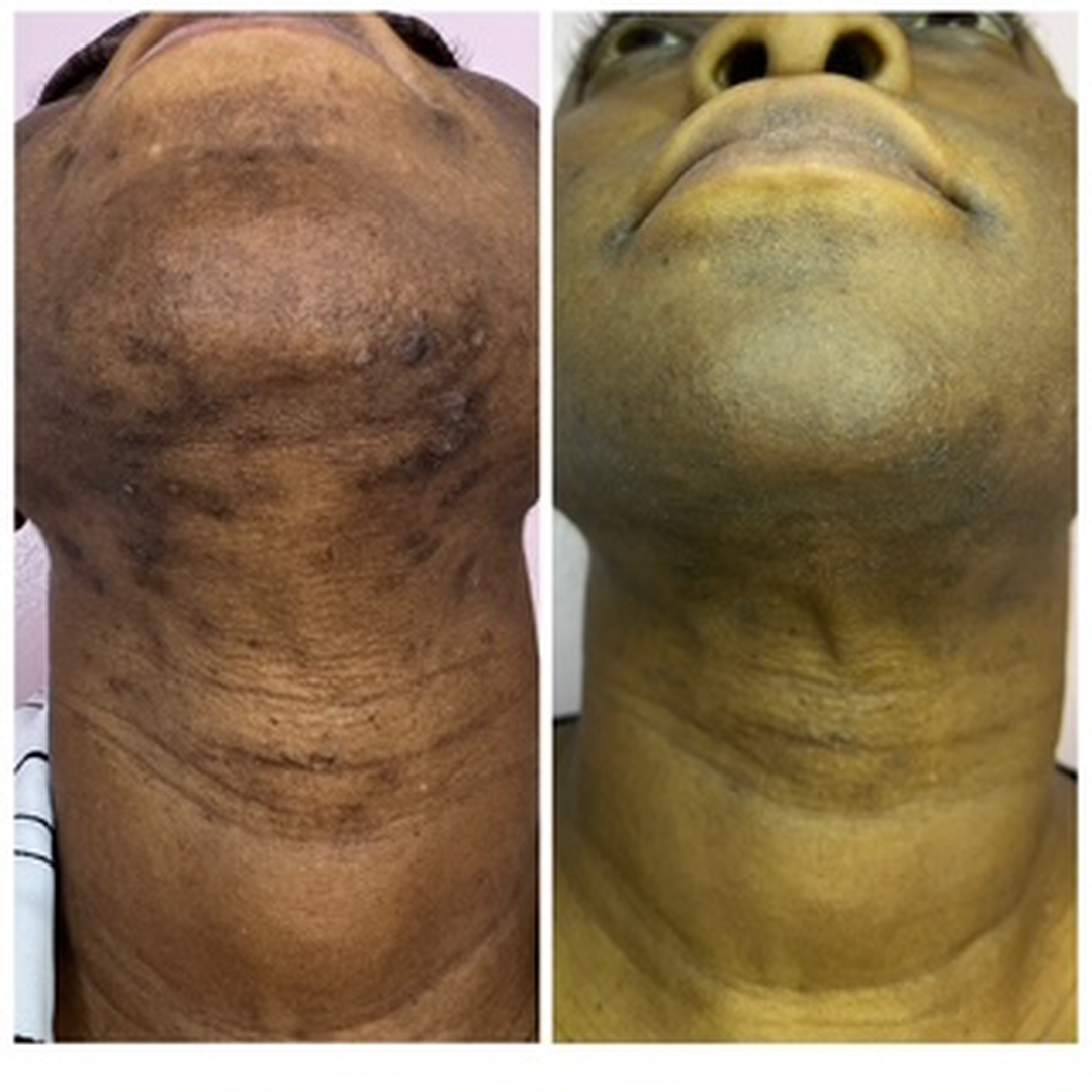 Houston Skin Treatment Image
