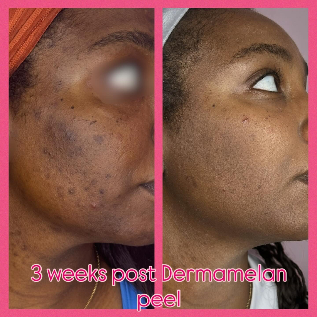 Houston Skin Treatment Image