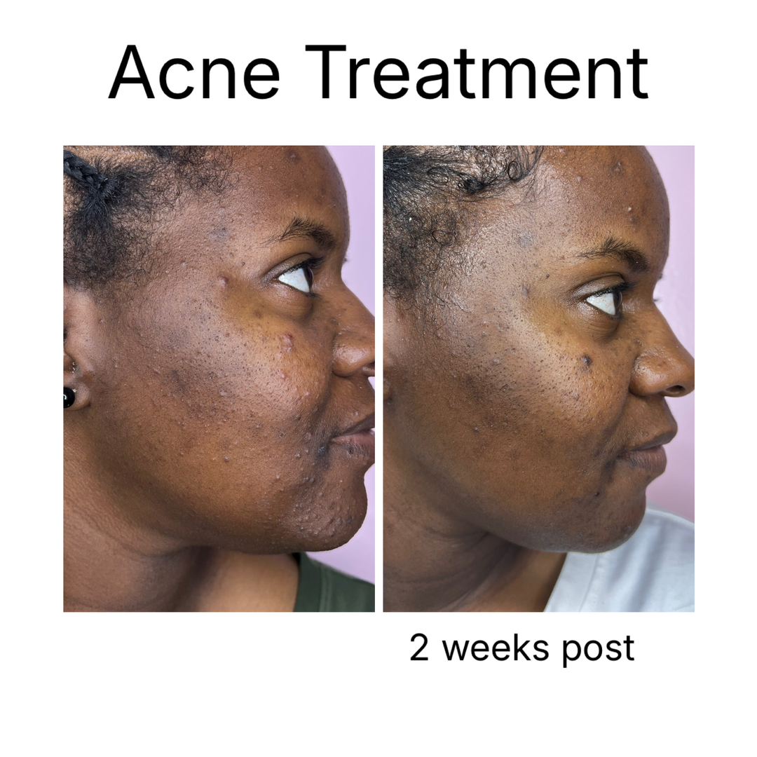 Houston Skin Treatment Image