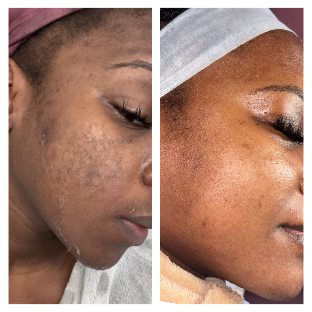 Houston Skin Treatment Image