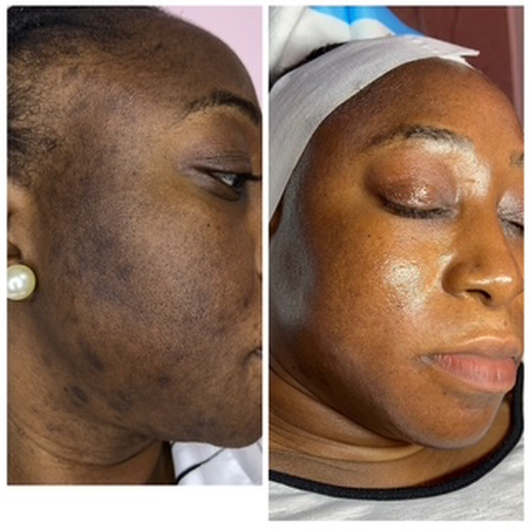Houston Skin Treatment Image