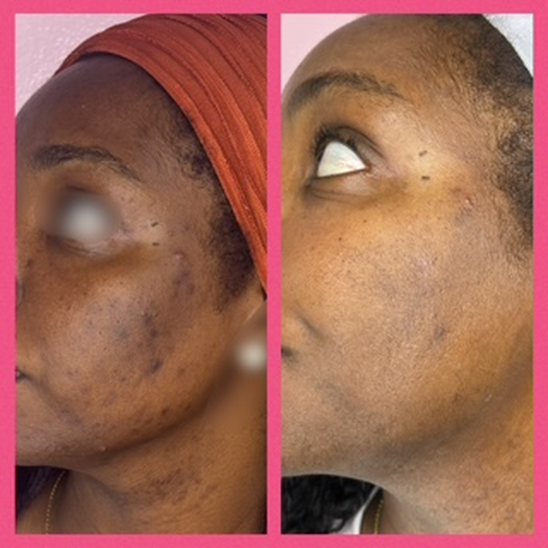 Houston Skin Treatment Logo