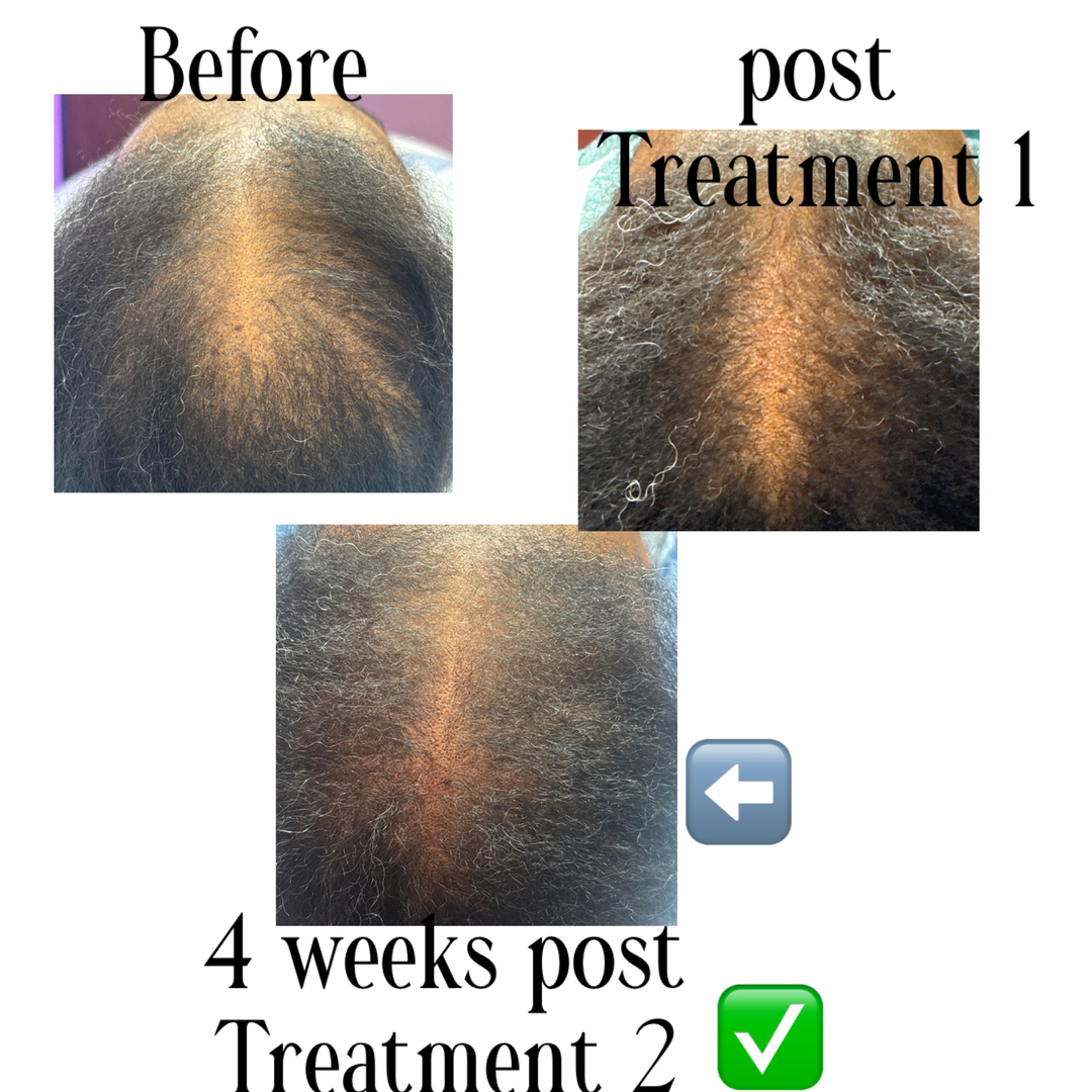 Houston Skin Treatment Image