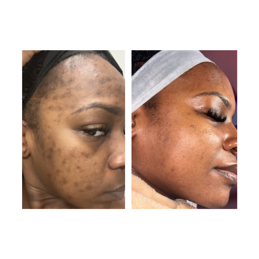 Houston Skin Treatment Image