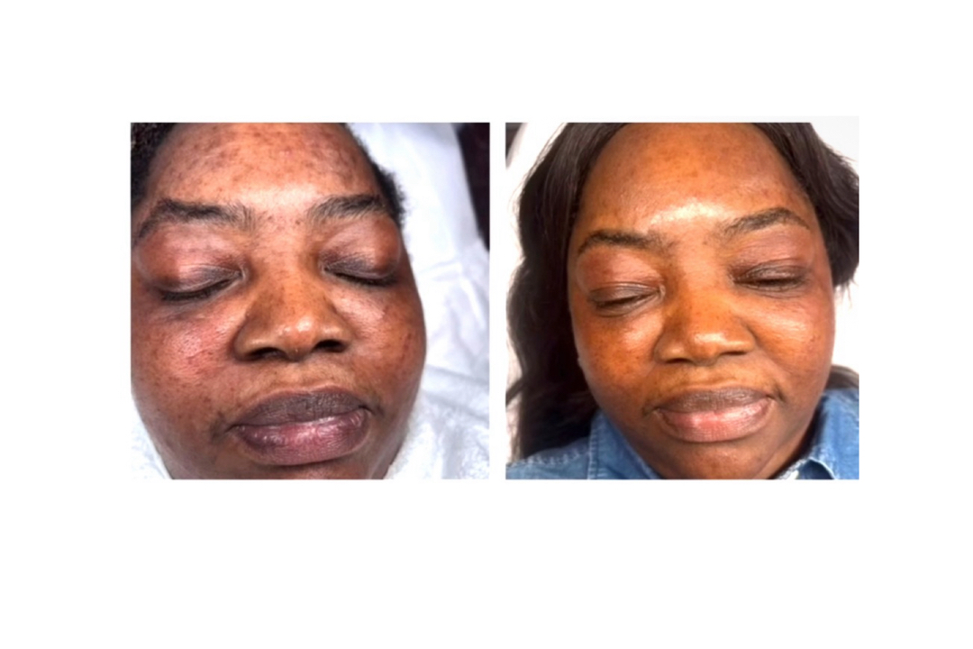 Houston Skin Treatment Image