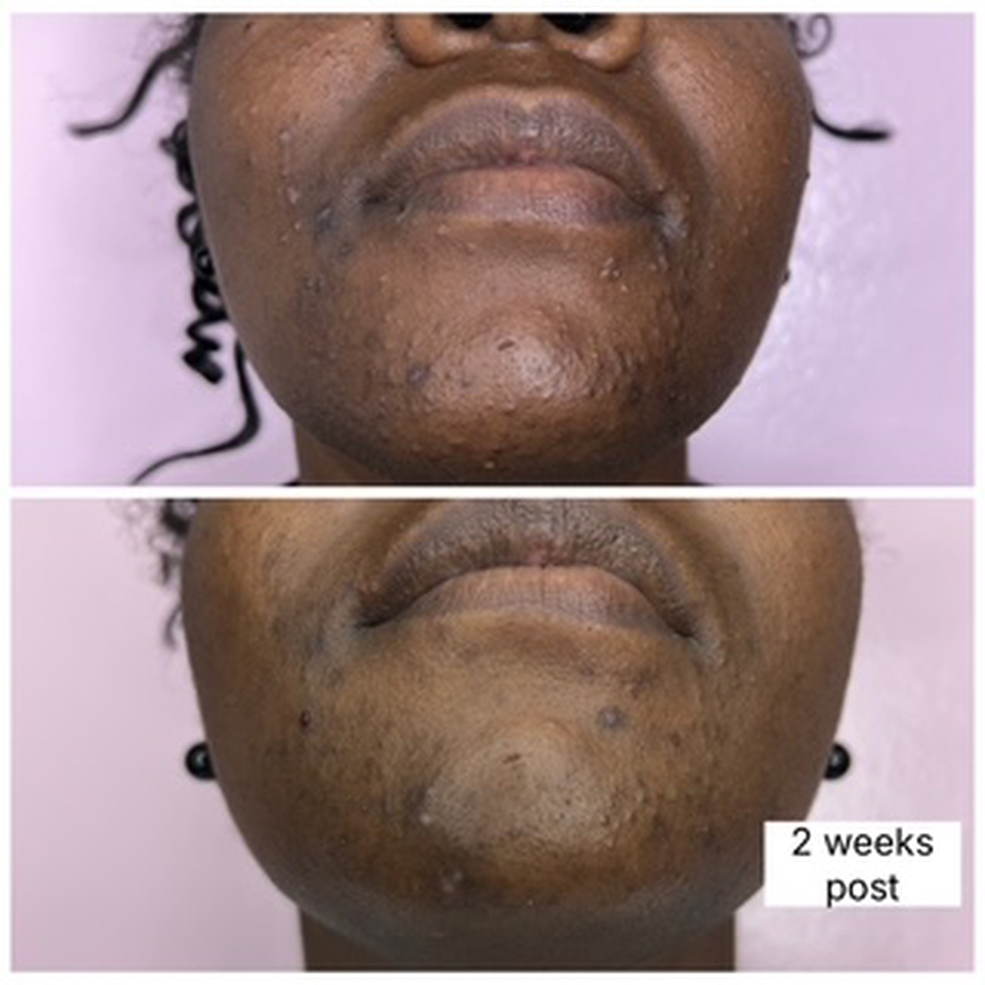 Houston Skin Treatment Image