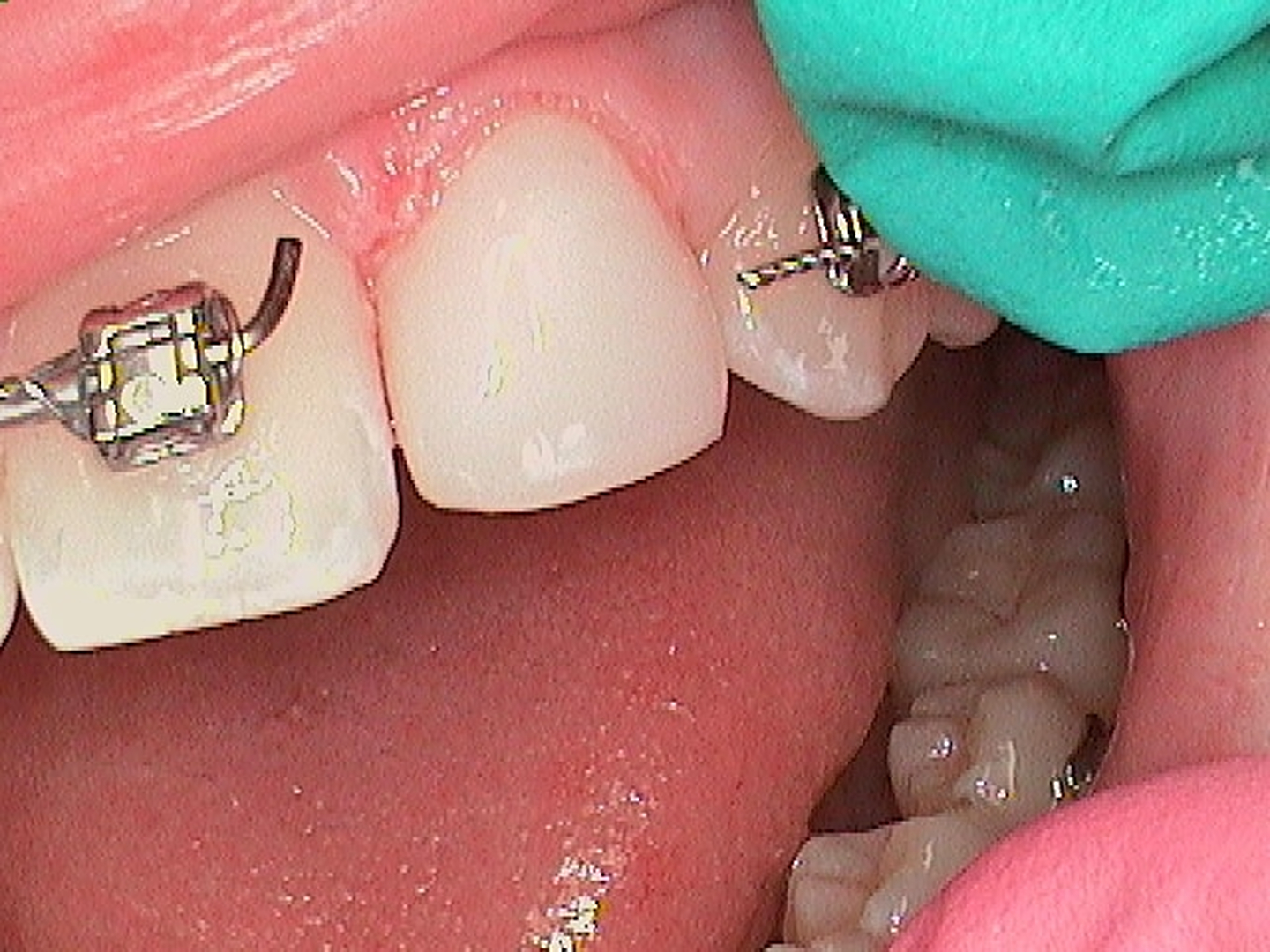 Nolan &amp; Freund Dental Professionals Logo