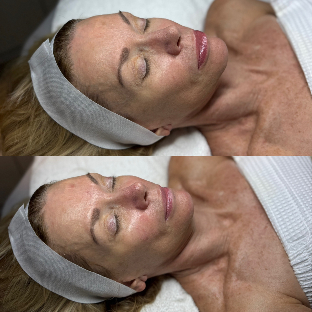 FAC Aesthetics Image