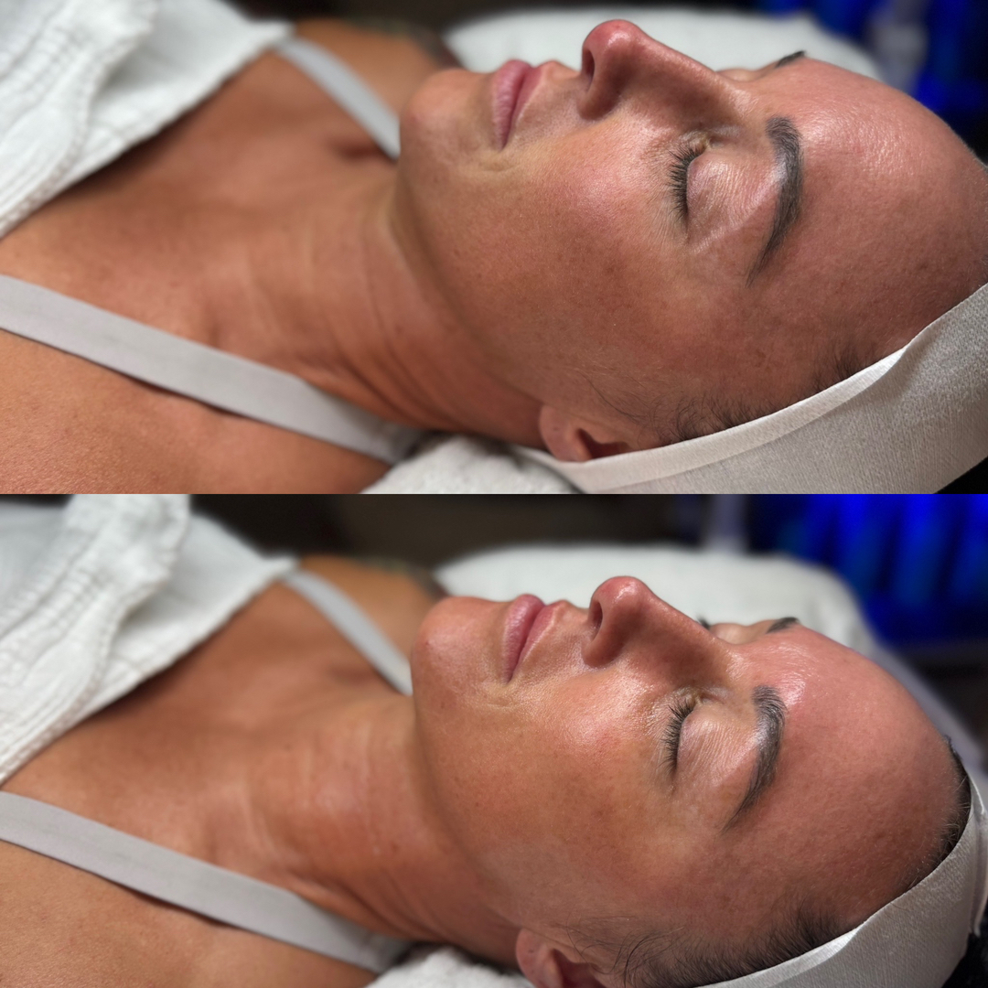 FAC Aesthetics Image