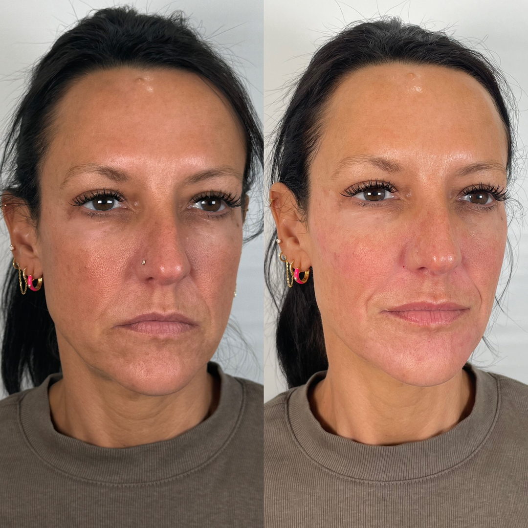 FAC Aesthetics Image