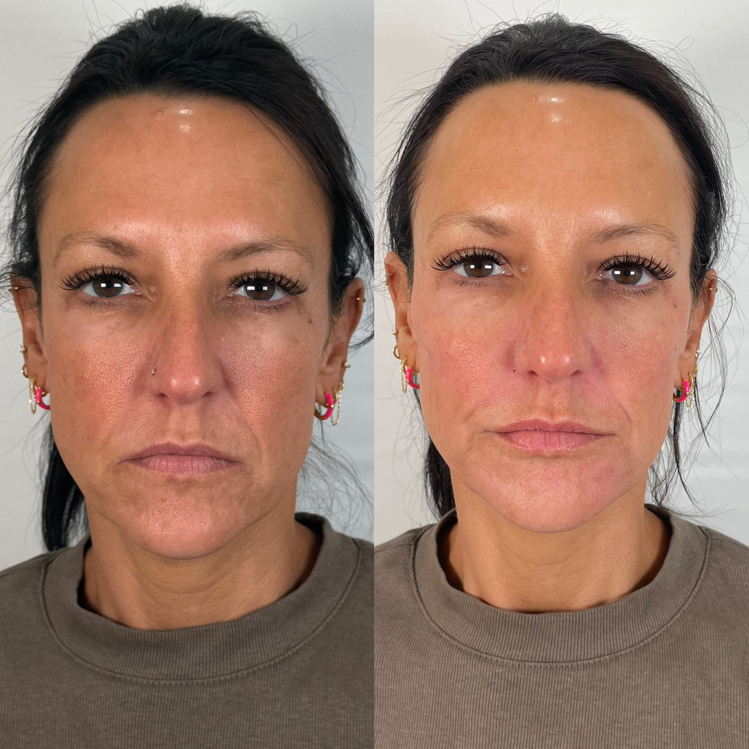 FAC Aesthetics Image