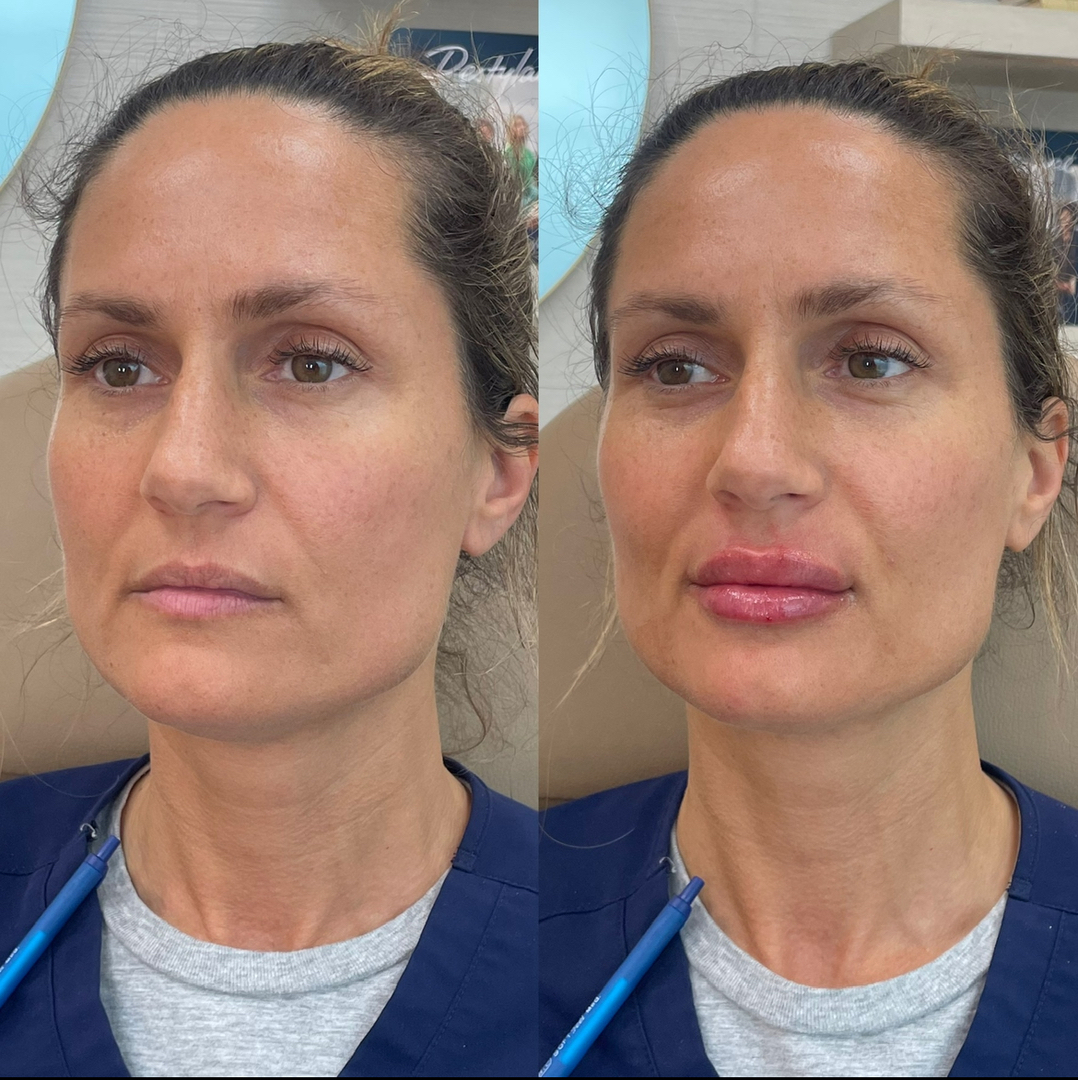 FAC Aesthetics Image