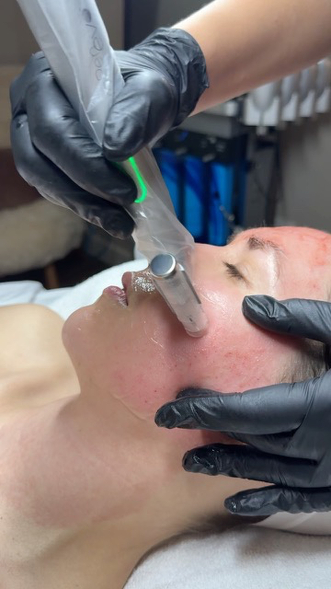 FAC Aesthetics Image