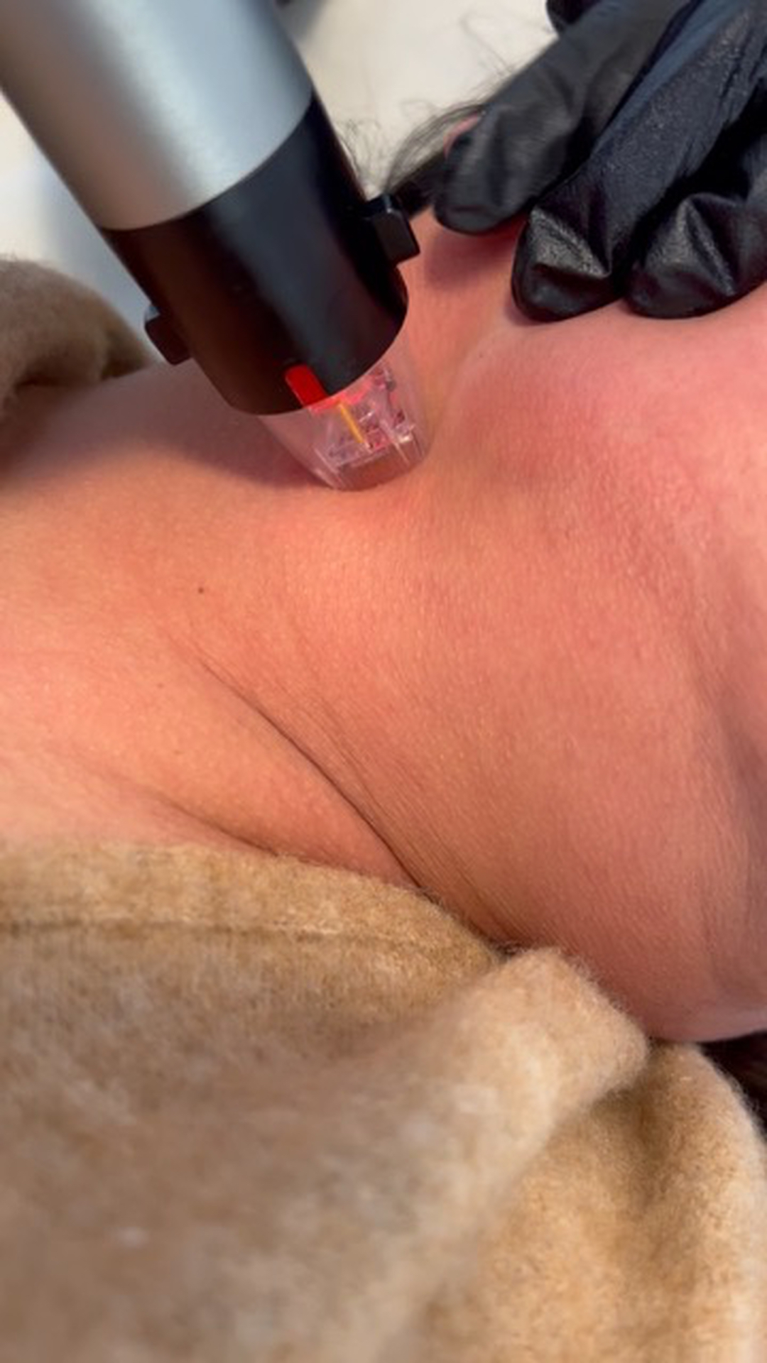 FAC Aesthetics Image