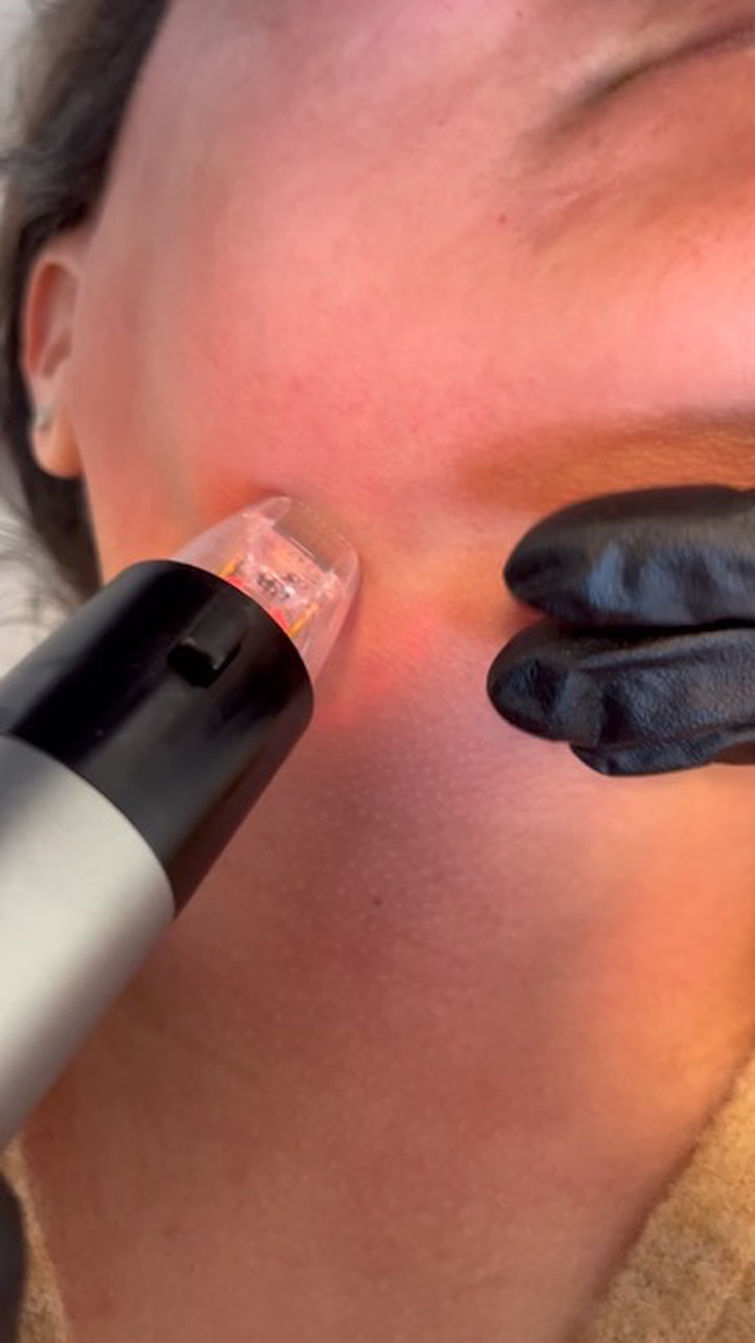 FAC Aesthetics Image