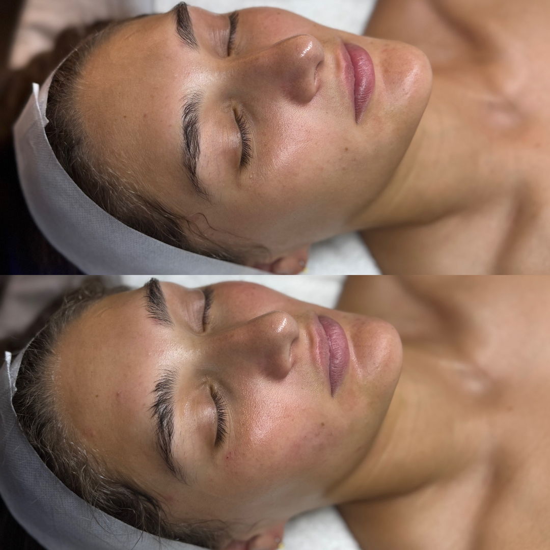 FAC Aesthetics Image