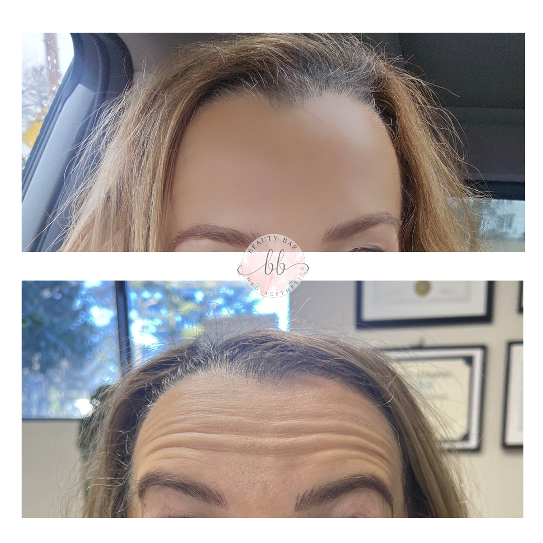 Beauty Bar Med Aesthetics Image