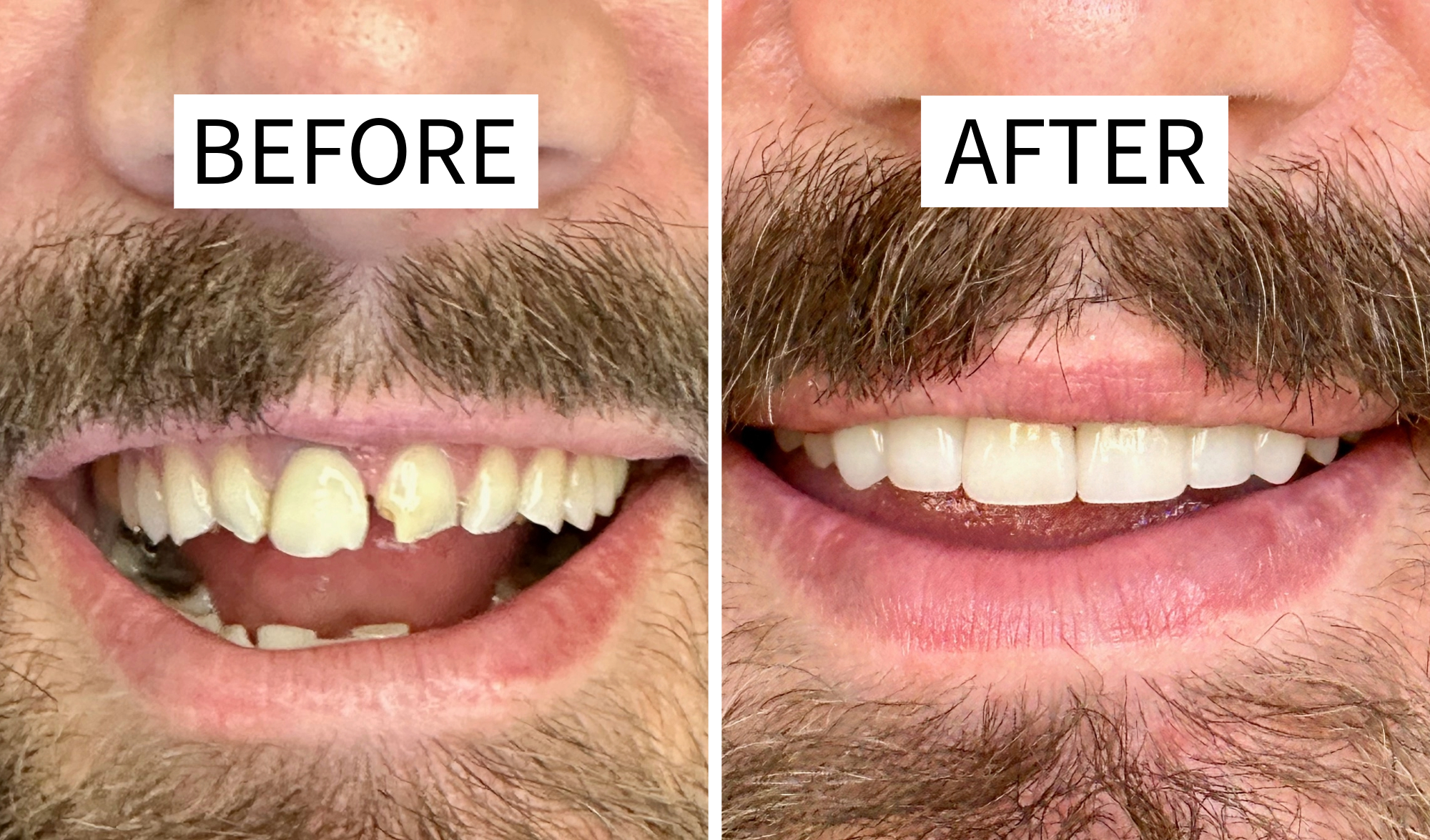 Advanced Dental Care - Mike Clark D.D.S. and Derek Tew D.D.S Image