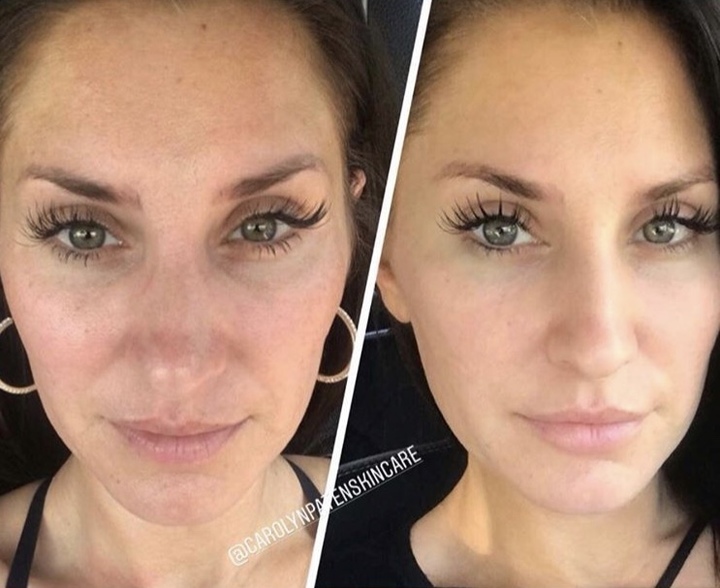 Carolyn Skincare Image