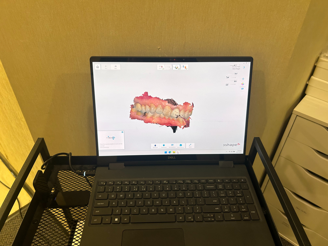 Mahwah Prime Dental - Cosmetic and Dental Implants, All-On-X | Serving Mahwah, Ramsey, Oakland, Suff Image