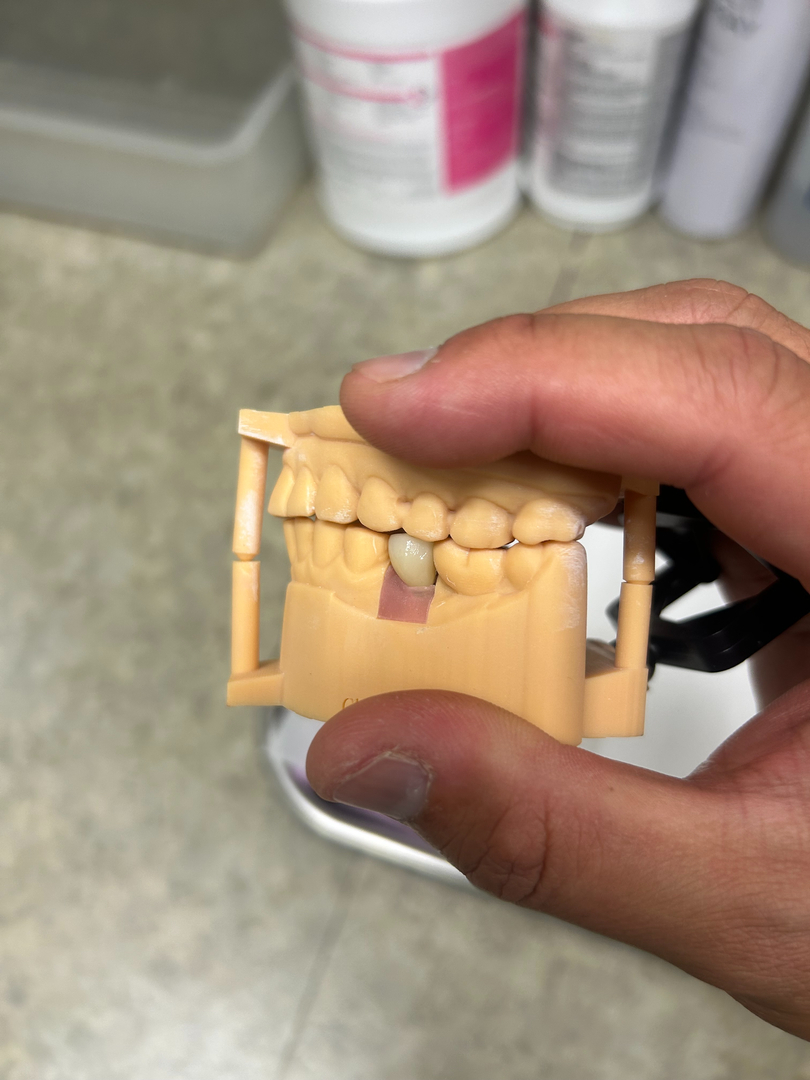 Mahwah Prime Dental - Cosmetic and Dental Implants, All-On-X | Serving Mahwah, Ramsey, Oakland, Suff Image