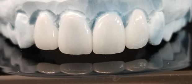 GALA Dental Art, LLC - West Hartford, CT