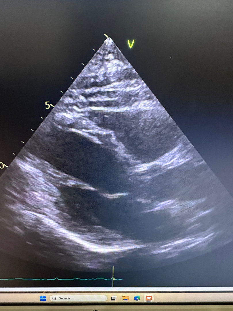 Prime Heart and Vascular Image