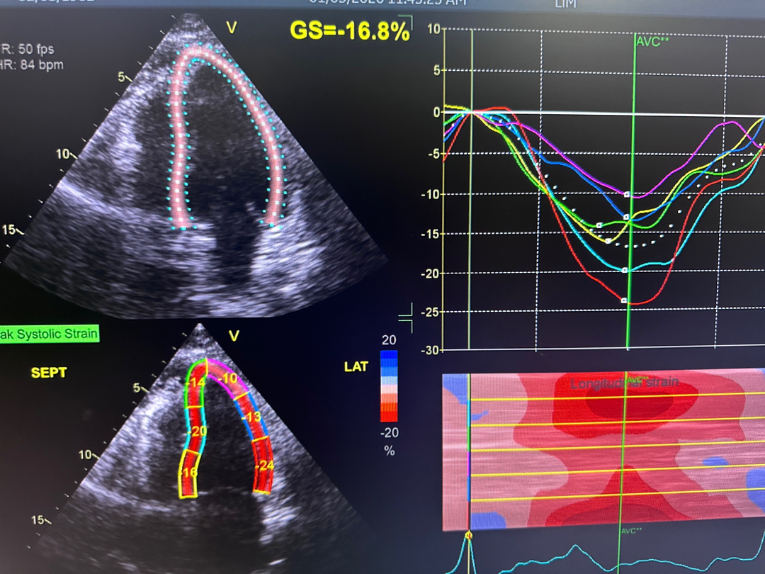 Prime Heart and Vascular Image