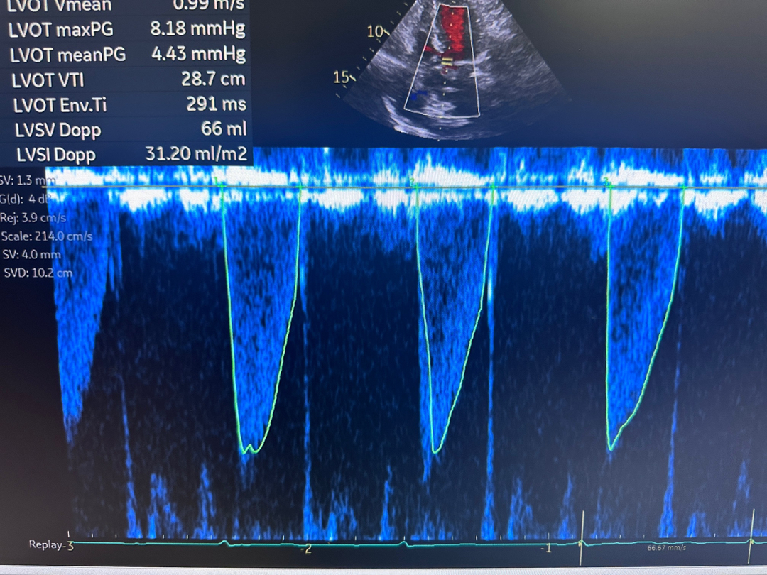Prime Heart and Vascular Image