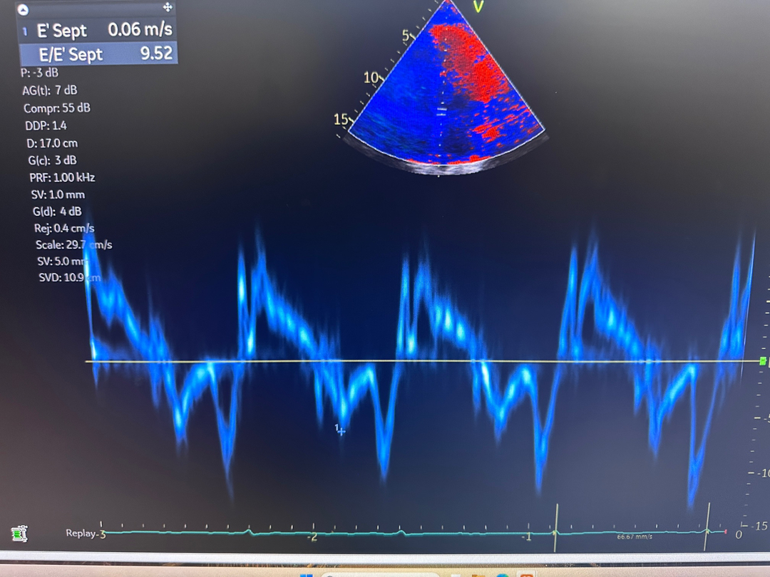 Prime Heart and Vascular Image