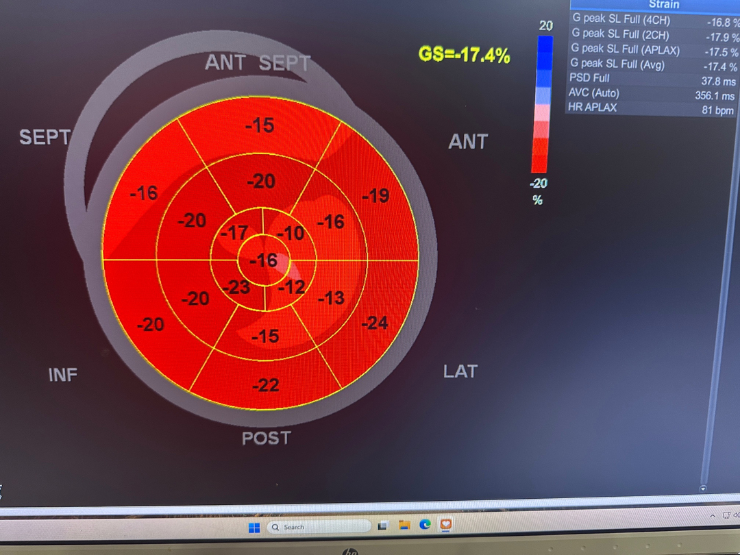 Prime Heart and Vascular Image
