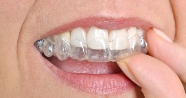 Gables Dental Care Image