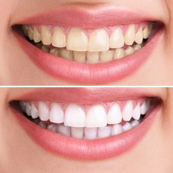Gables Dental Care Image
